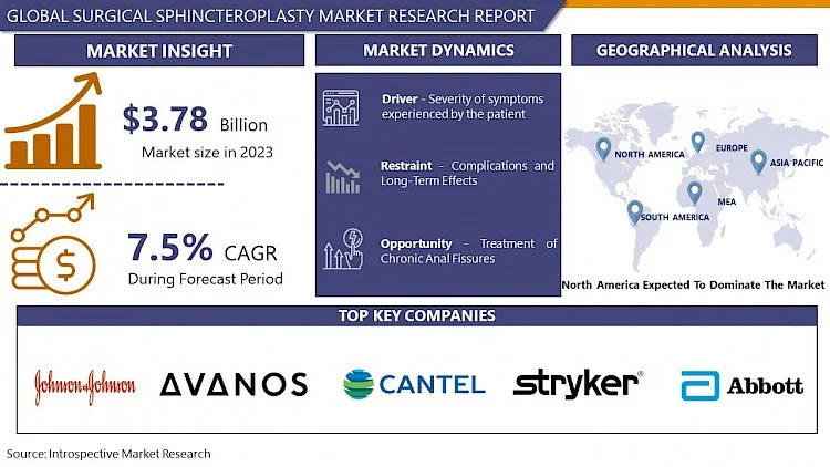 Surgical Sphincteroplasty Market Latest Research Report, Business Opportunities, Size Predicts Favourable Growth | IMR